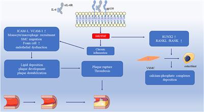 The Role of Interleukin-6 Family Members in Cardiovascular Diseases